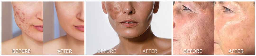 Kim’s Skincare Protocol Customer Experience